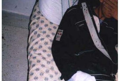 Etudiant blessé à la main et à la tête